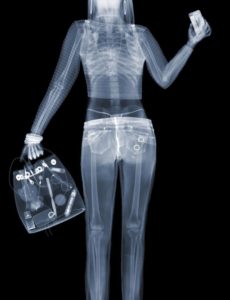 Röntgen kép nő